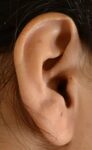 File:Human Ear.jpg - Wikimedia Commons